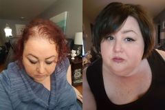 Tims-Before-And-After-14