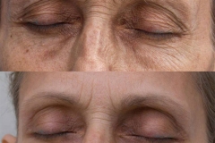 Tims-Before-and-After-