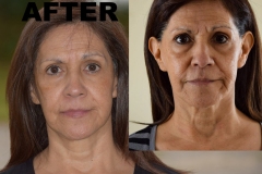 Tims-Before-and-After-2